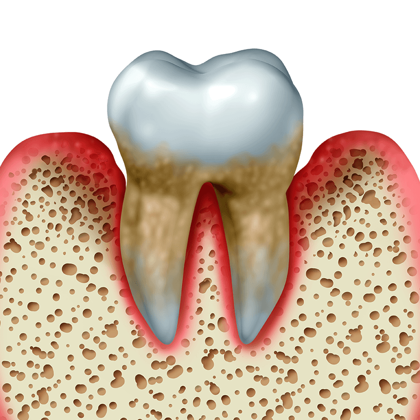 Illustration of gums