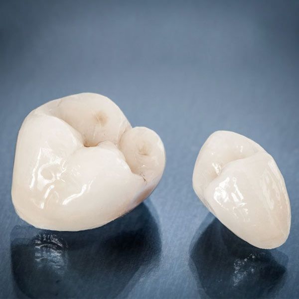 Dental crowns