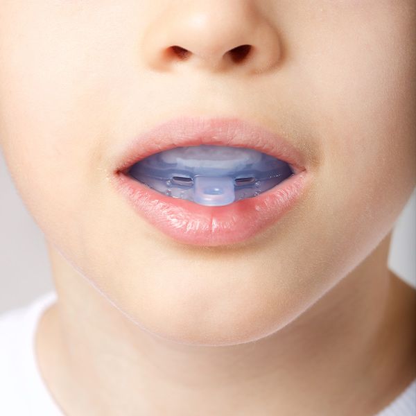 Child wearing Myobrace device