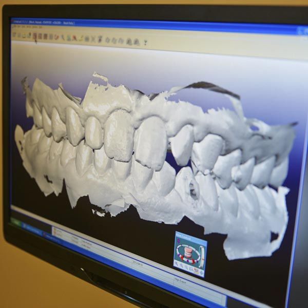 Digital x-ray of patient's oral cavity